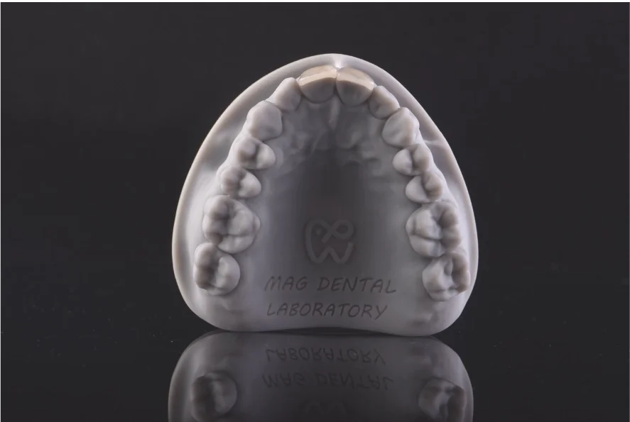 Dental model prepared for ceramic veneer restorations